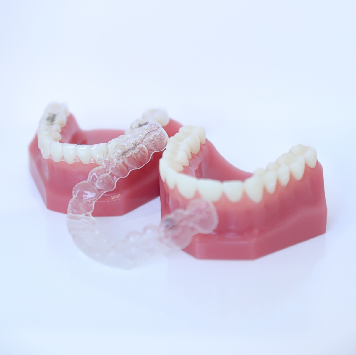 invisalign aligners 