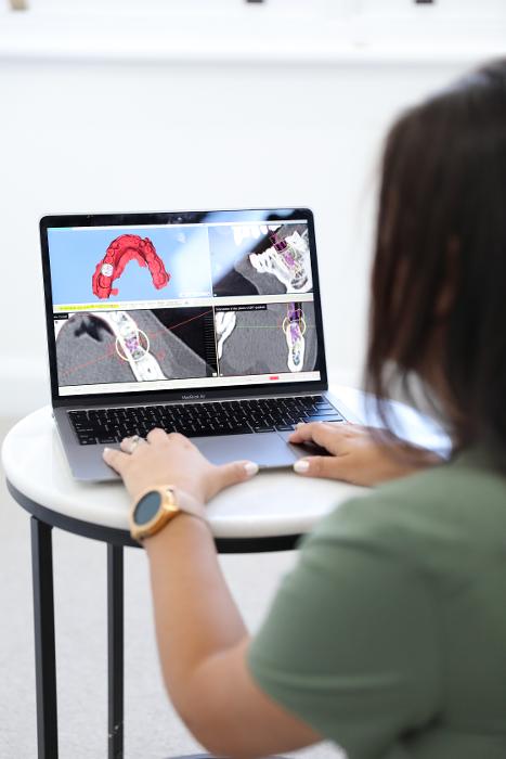 Smileshq dentist doing digital work for smile rehabilitation
