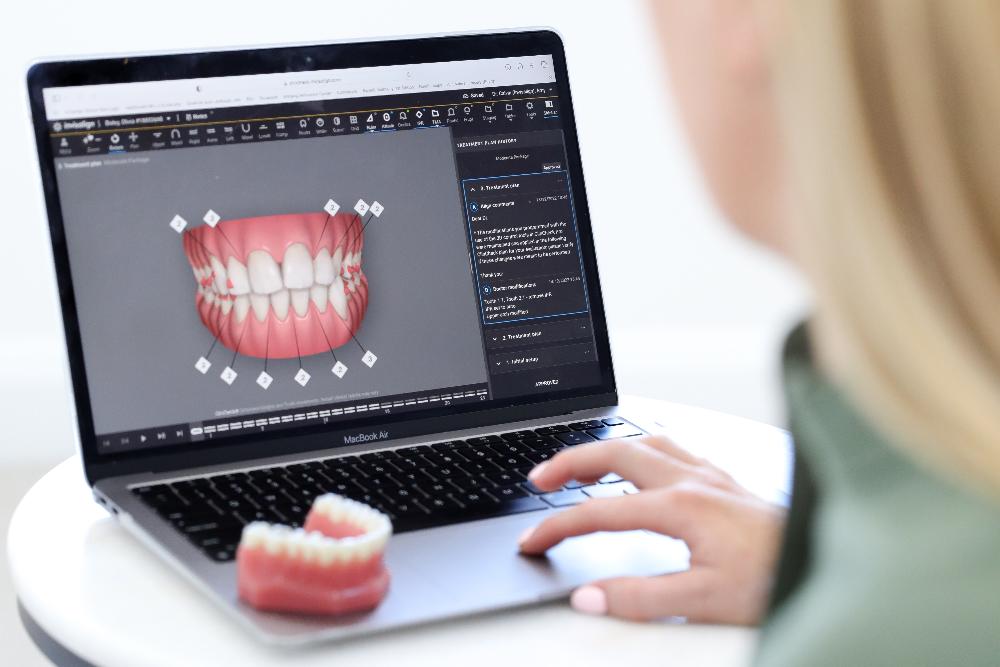 creating a digital smile design in warners bay