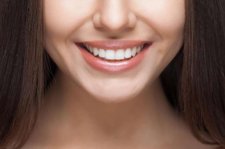 woman smiling after a smile makeover in warners bay