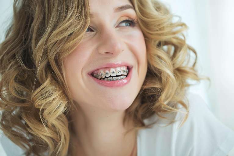 woman with braces smiling