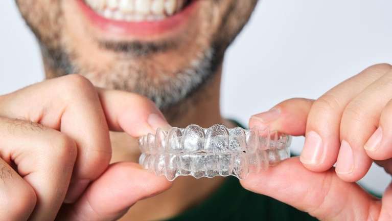warners bay man holding invisalign aligners