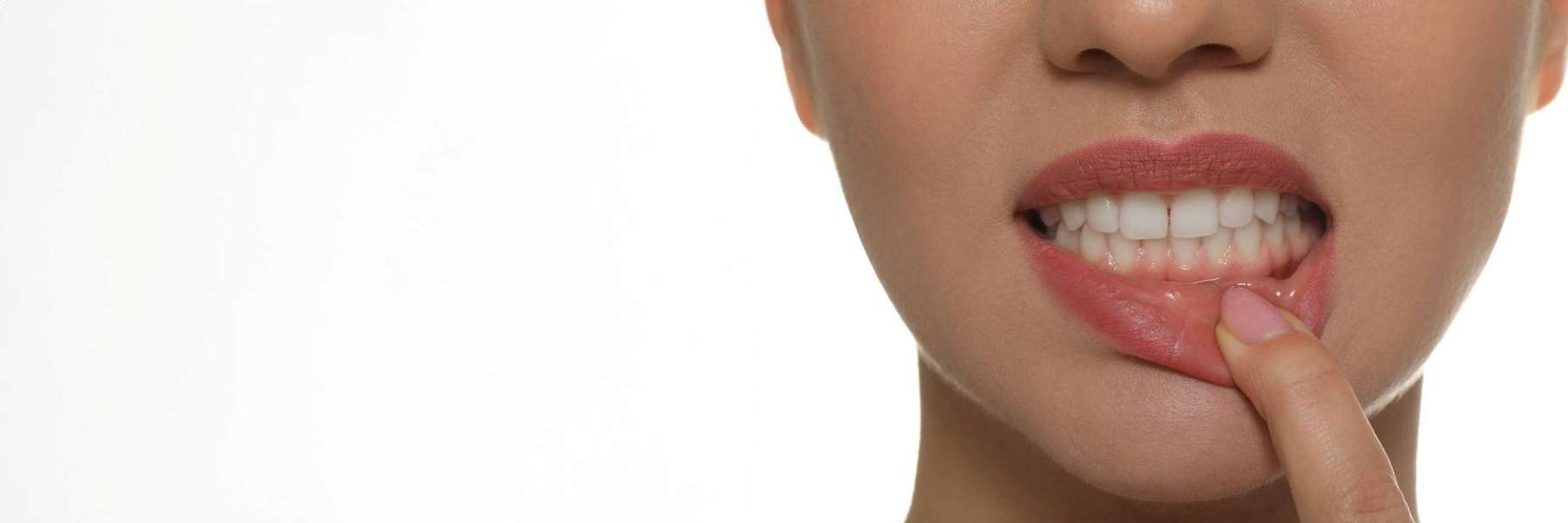 close up of warners bay patient's smile